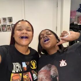 DRDENT Purple Teeth Whitening Strips - 7/21 Whitening Sessions - Safe for Enamel - Non Sensitive Teeth Whitening - Peroxide-Free photo review