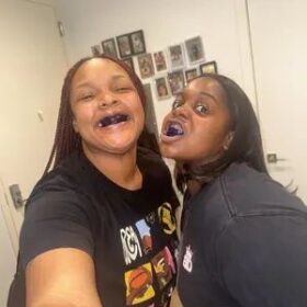 DRDENT Purple Teeth Whitening Strips - 7/21 Whitening Sessions - Safe for Enamel - Non Sensitive Teeth Whitening - Peroxide-Free photo review