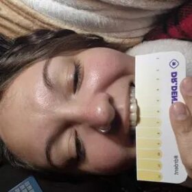 DRDENT Purple Teeth Whitening Strips - 7/21 Whitening Sessions - Safe for Enamel - Non Sensitive Teeth Whitening - Peroxide-Free photo review