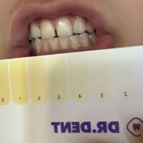DRDENT Purple Teeth Whitening Strips - 7/21 Whitening Sessions - Safe for Enamel - Non Sensitive Teeth Whitening - Peroxide-Free photo review